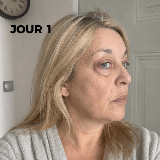Ce n'est pas de la fatigue. C'est votre muscle qui lâche.