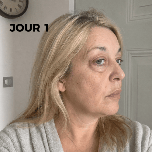 LVMISENS™ PRO ONE — Soin Anti-Poches Sous les Yeux