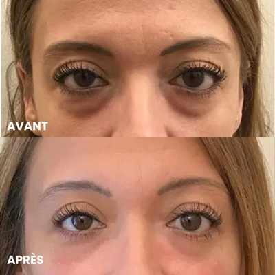 Avis client