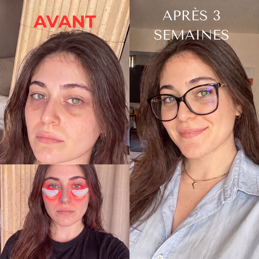 LVMISENS™ PRO ONE — Soin Anti-Poches Sous les Yeux